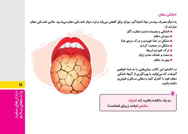گنجینه‌ی مغزی